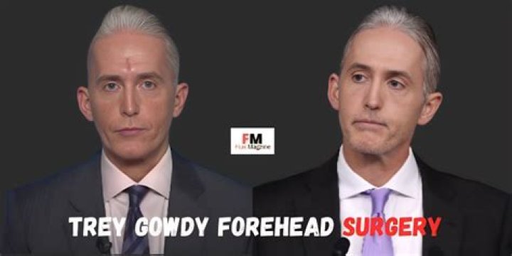Trey Gowdy's Nose: A Unique Feature of a Prominent Figure