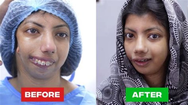 Unveiling Alina Habba's Transformation: The Journey of Plastic Surgery