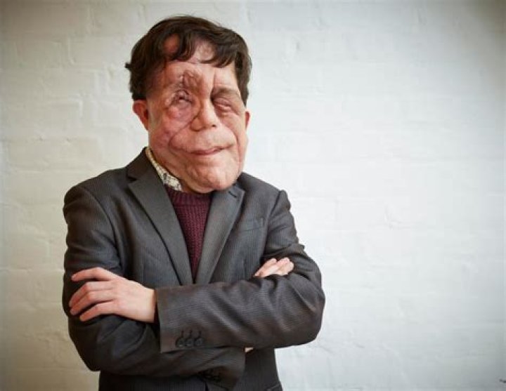 Unveiling the Life and Journey of Adam Pearson