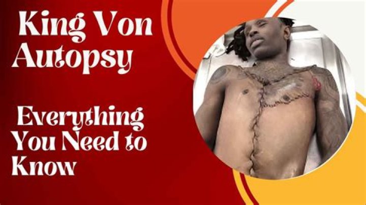 Unveiling the Truth: The King Von Autopsy